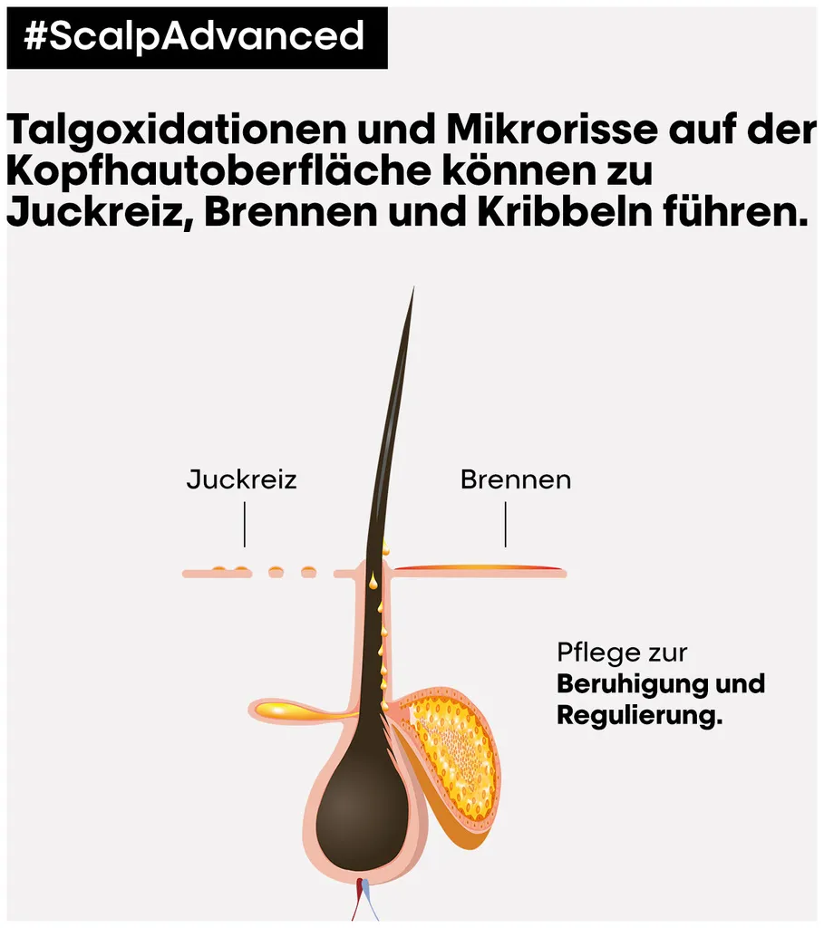 L'Oréal Scalp Advanced Anti-Discomfort Intense Soother Treatment