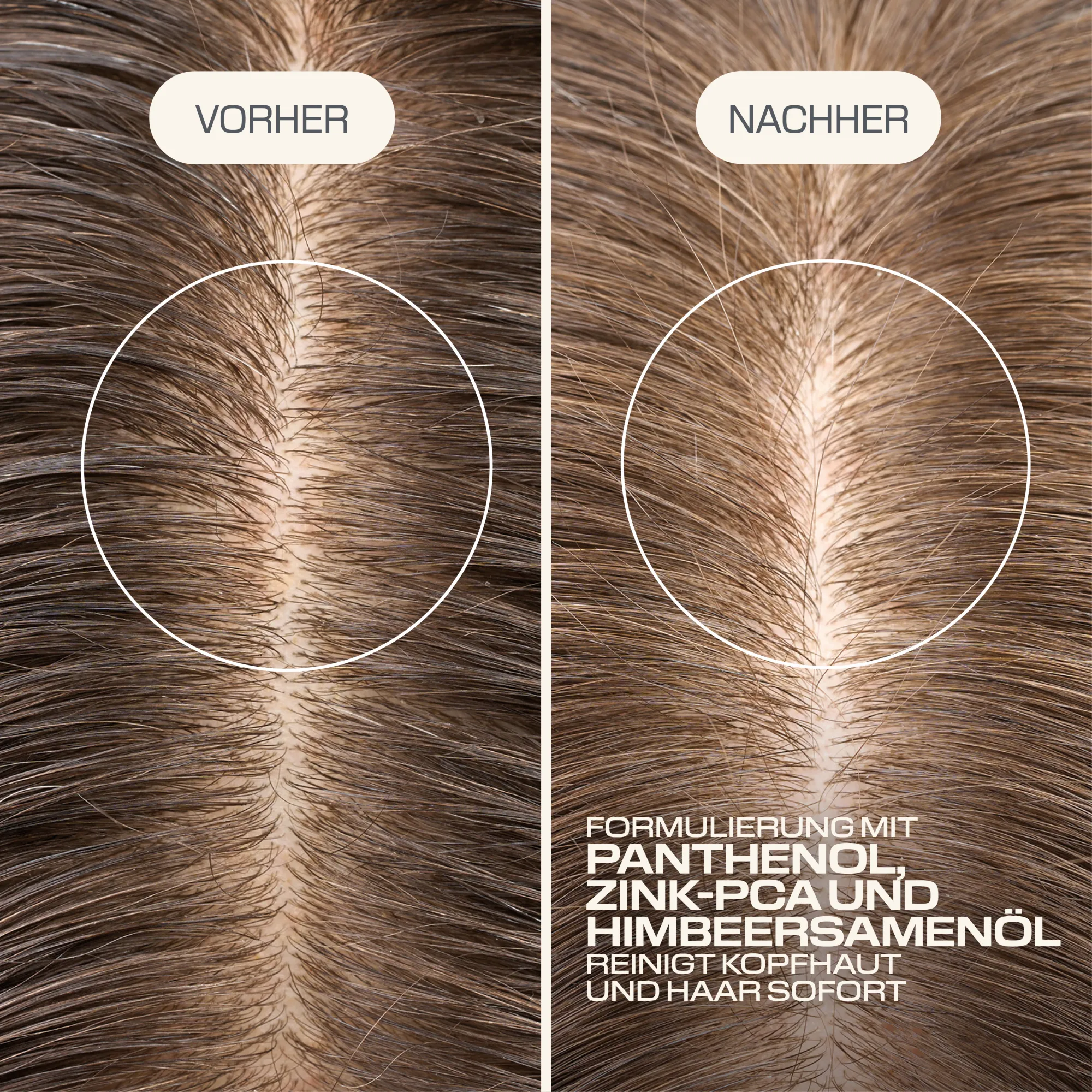 Goldwell DS SCALP SPECIALIST Tiefenreinigungsshampoo