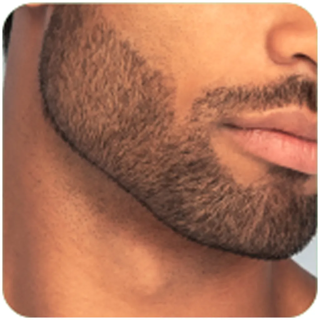 Remington T-Series Ultimate Precision Bartschneider MB7000